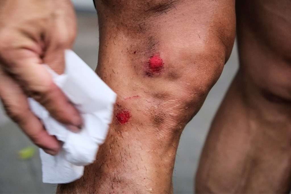 Treating-A-Wound-Image1