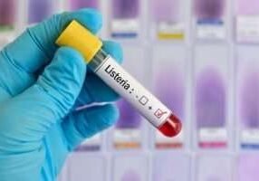About-Listeria-Infections-Image1
