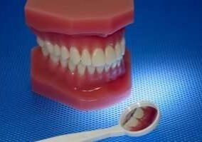 Photo of a Mouth Model and a Oral Mirror - Oral Health Related
